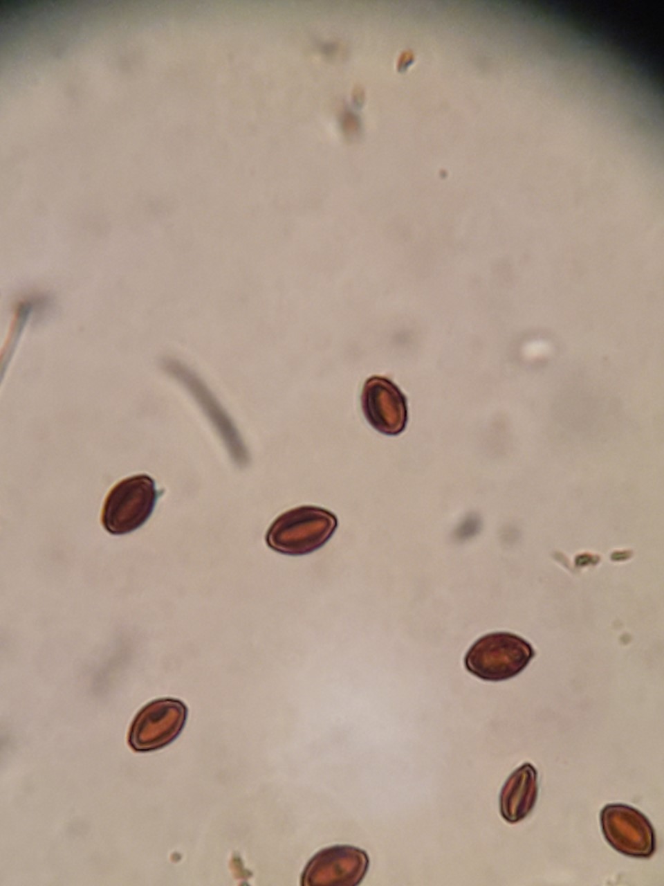 Thermal tolerance and environmental persistence of a protozoan parasite ...